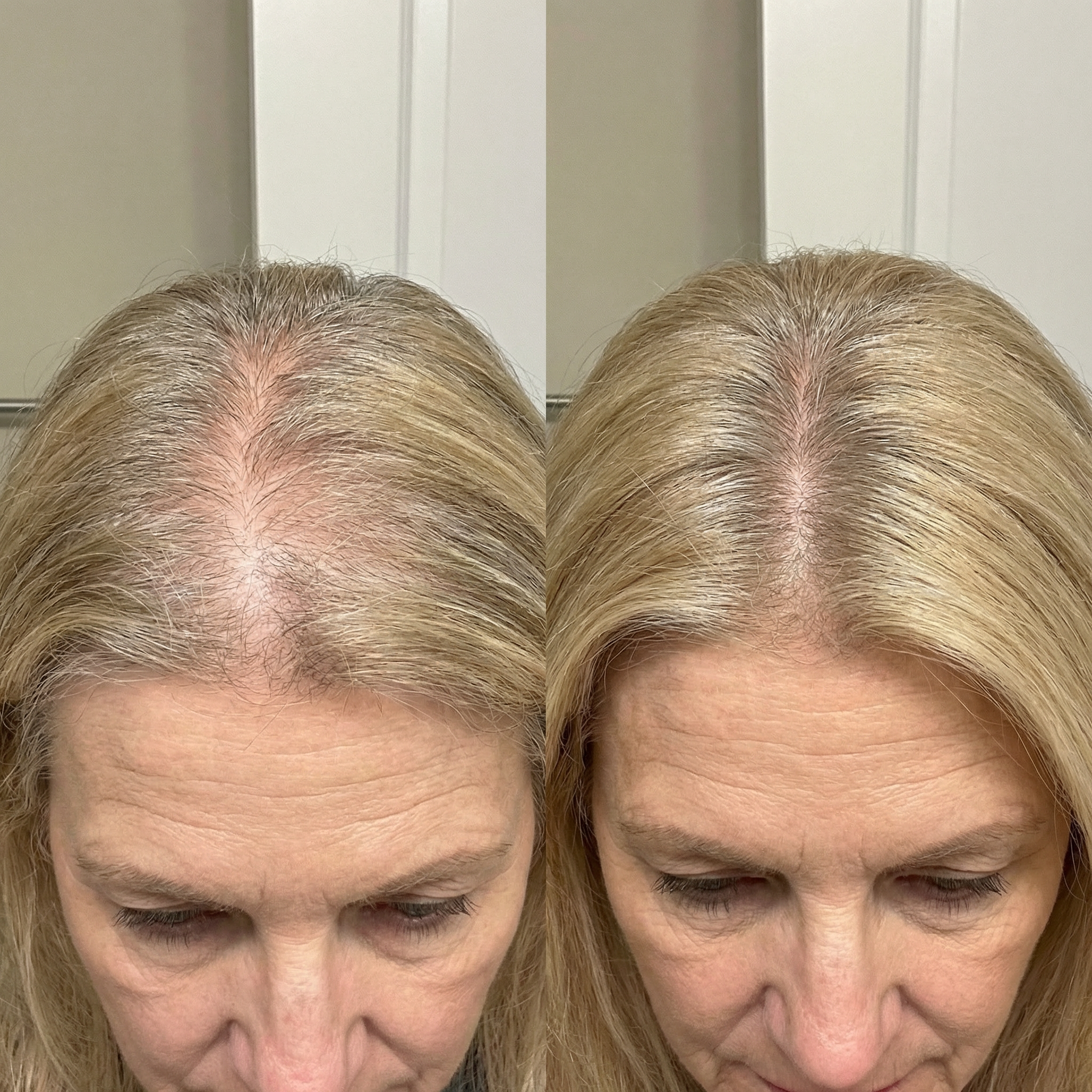 Linda K. before and after