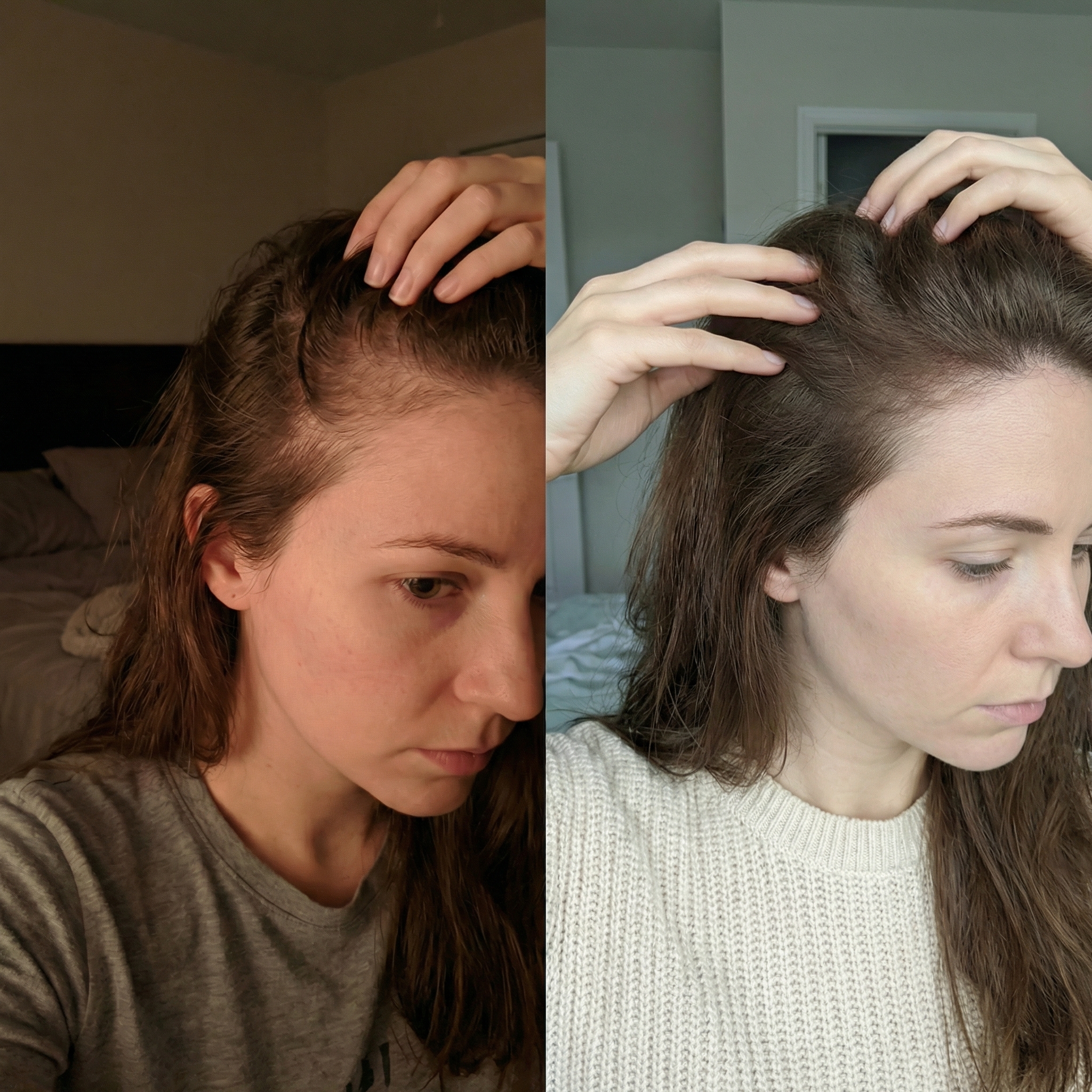 Amanda R. before and after