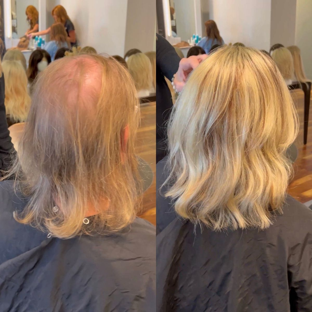 Sarah M. before and after